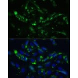 Immunofluorescence - Anti-CGRP-1 Antibody (A11847) - Antibodies.com