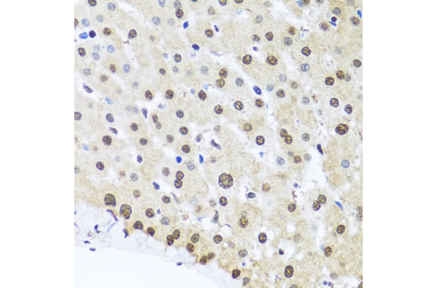 Immunohistochemistry - Anti-FUBP1/FBP Antibody (A11849) - Antibodies.com