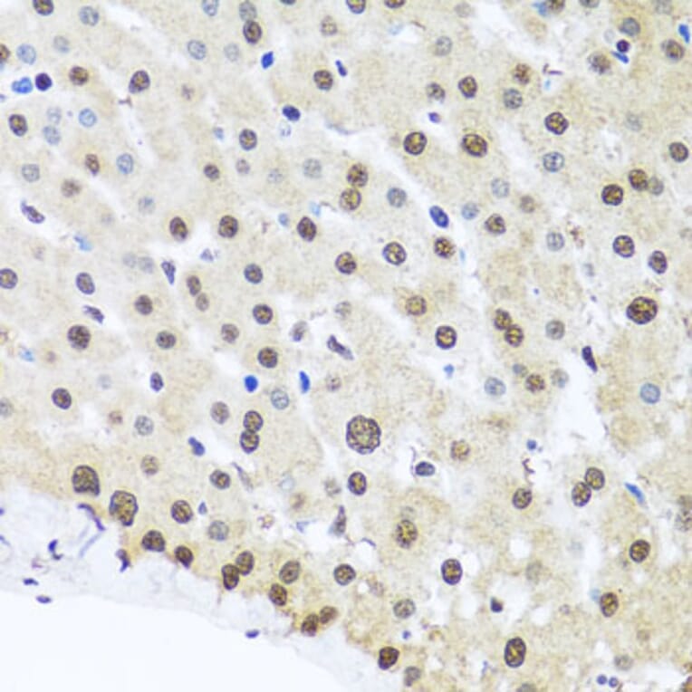 Immunohistochemistry - Anti-FUBP1/FBP Antibody (A11849) - Antibodies.com