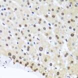 Immunohistochemistry - Anti-FUBP1/FBP Antibody (A11849) - Antibodies.com