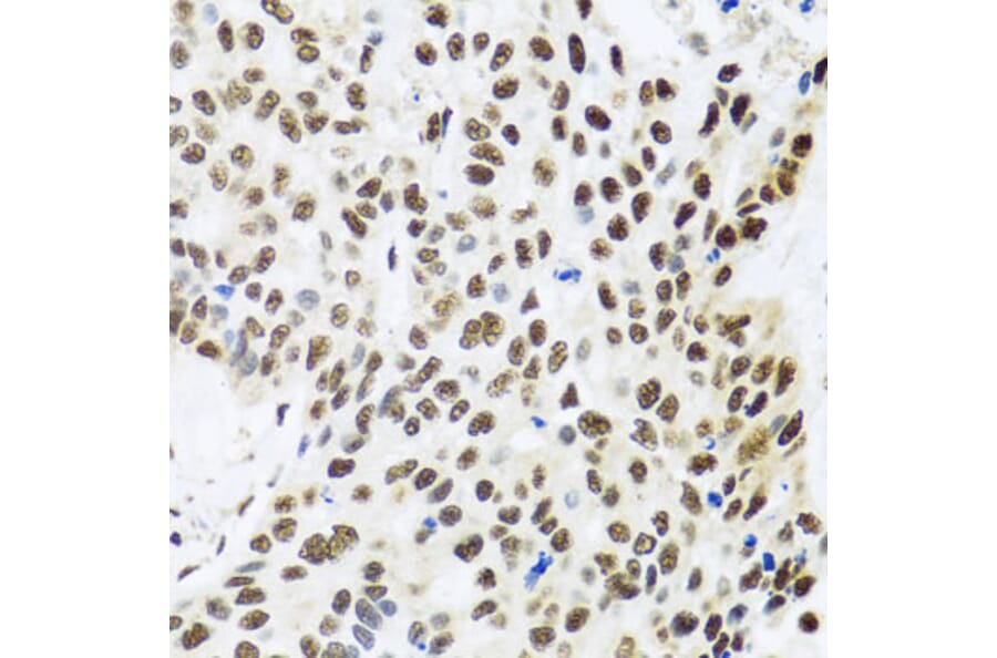 Immunohistochemistry - Anti-FUBP1/FBP Antibody (A11849) - Antibodies.com