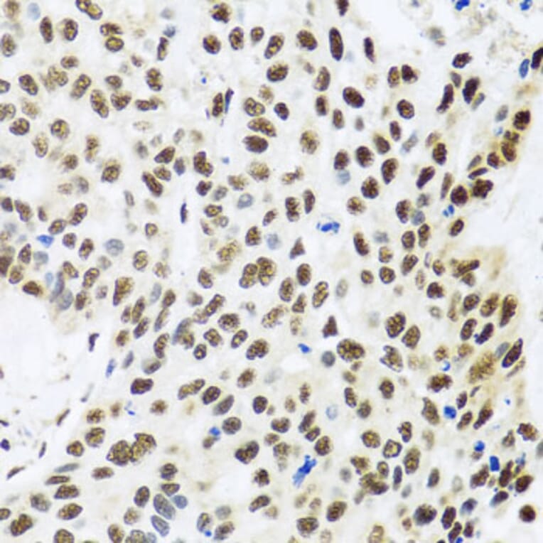Immunohistochemistry - Anti-FUBP1/FBP Antibody (A11849) - Antibodies.com
