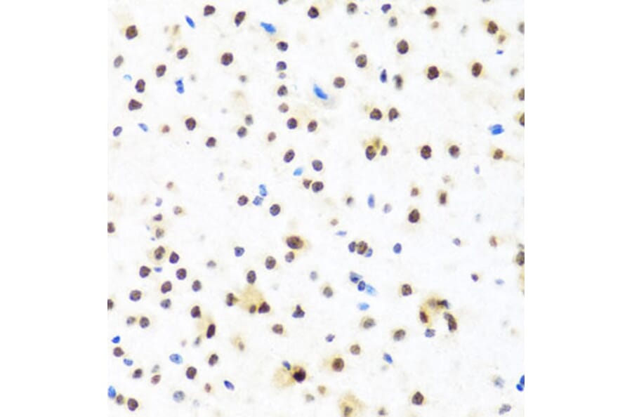 Immunohistochemistry - Anti-FUBP1/FBP Antibody (A11849) - Antibodies.com