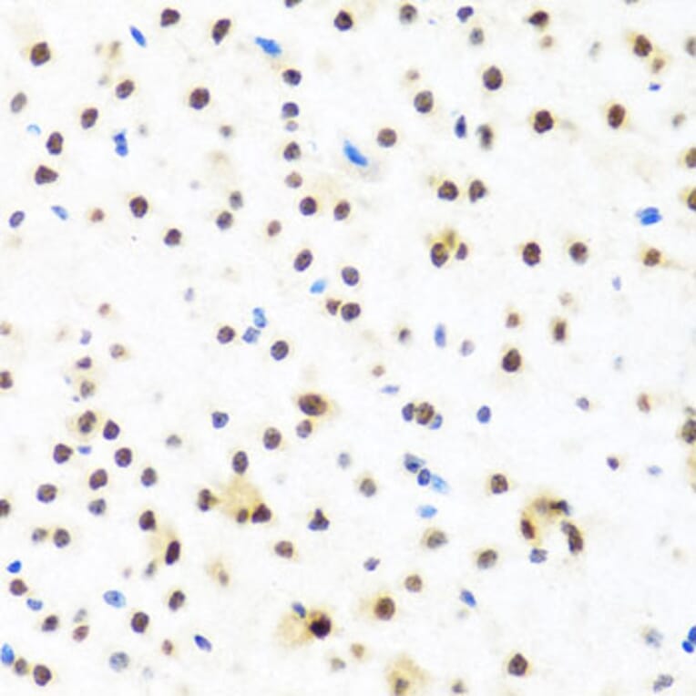 Immunohistochemistry - Anti-FUBP1/FBP Antibody (A11849) - Antibodies.com