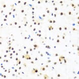 Immunohistochemistry - Anti-FUBP1/FBP Antibody (A11849) - Antibodies.com