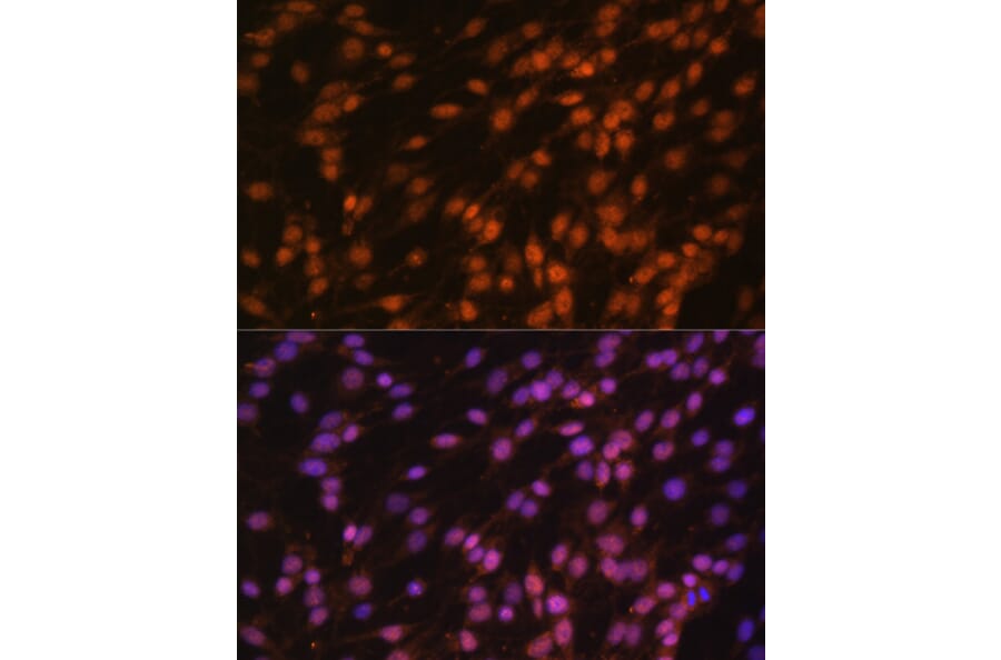 Immunofluorescence - Anti-FUBP1/FBP Antibody (A11849) - Antibodies.com