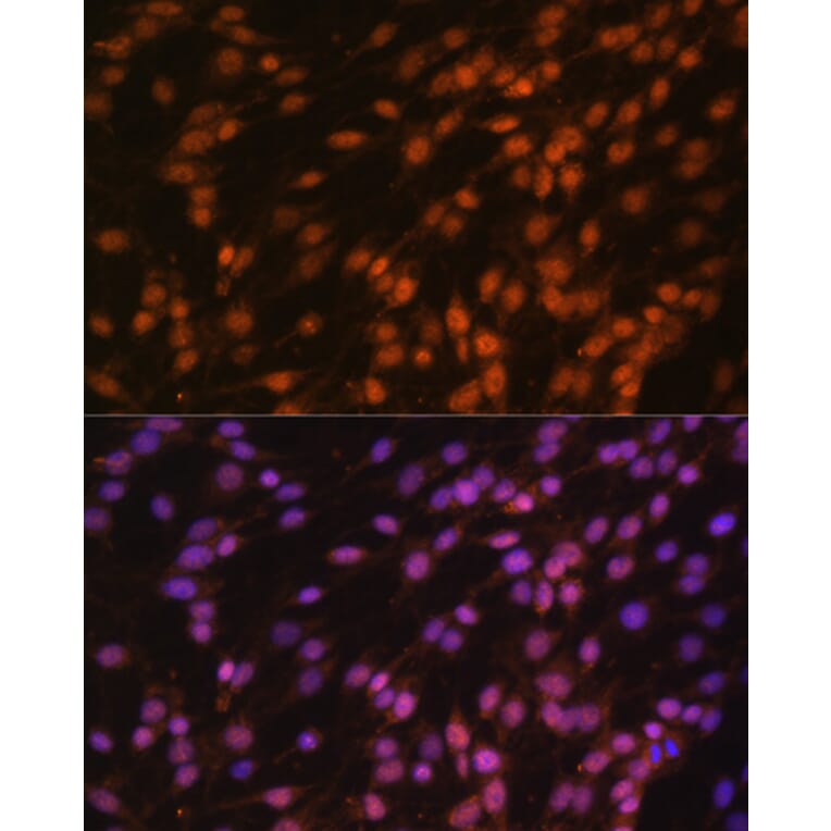 Immunofluorescence - Anti-FUBP1/FBP Antibody (A11849) - Antibodies.com