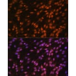 Immunofluorescence - Anti-FUBP1/FBP Antibody (A11849) - Antibodies.com