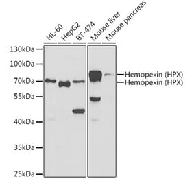 Western Blot - Anti-Hemopexin Antibody (A11850) - Antibodies.com