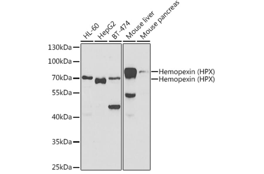 Western Blot - Anti-Hemopexin Antibody (A11850) - Antibodies.com
