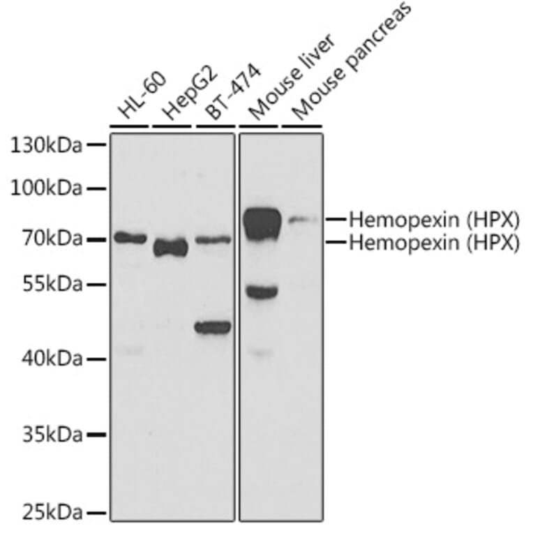 Western Blot - Anti-Hemopexin Antibody (A11850) - Antibodies.com