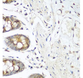 Immunohistochemistry - Anti-VEGF Receptor 3 Antibody (A11851) - Antibodies.com