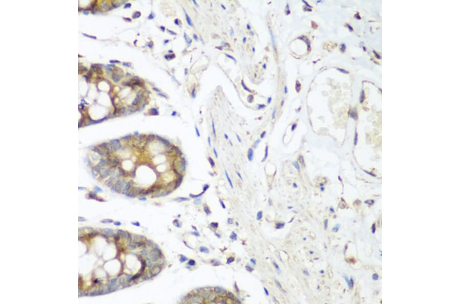 Immunohistochemistry - Anti-VEGF Receptor 3 Antibody (A11851) - Antibodies.com