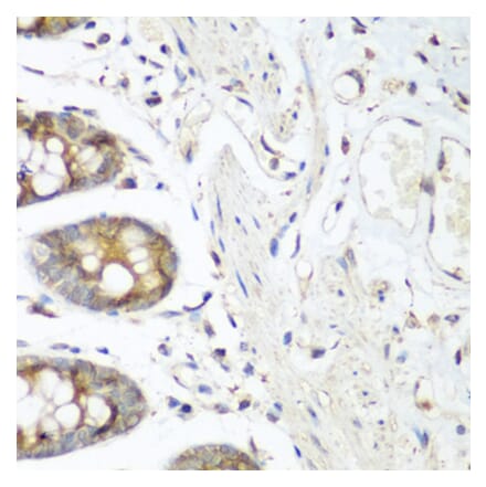 Immunohistochemistry - Anti-VEGF Receptor 3 Antibody (A11851) - Antibodies.com