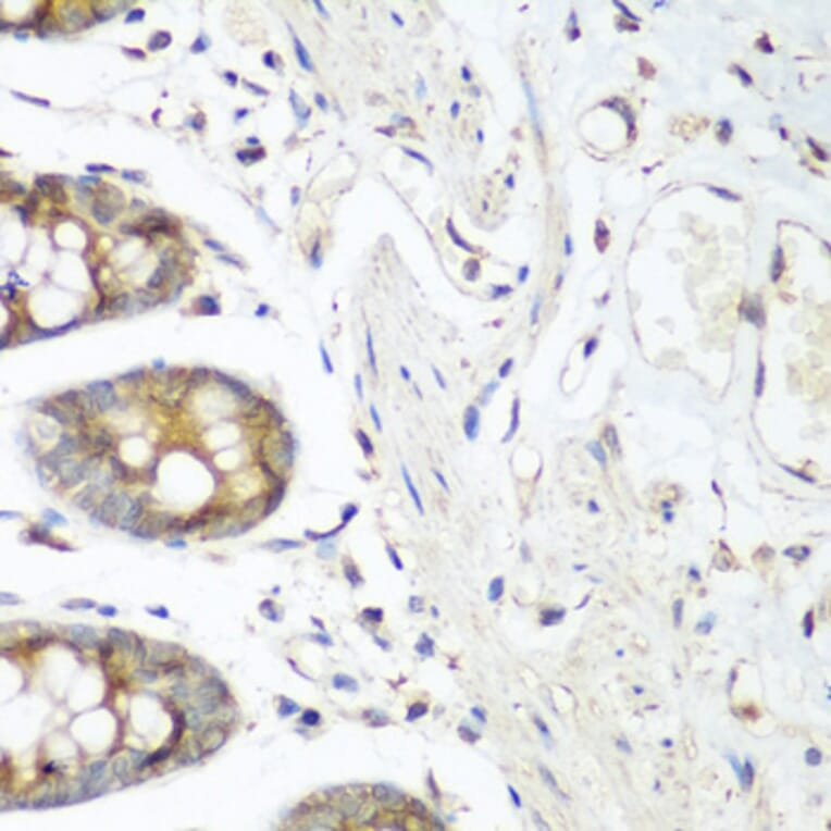 Immunohistochemistry - Anti-VEGF Receptor 3 Antibody (A11851) - Antibodies.com