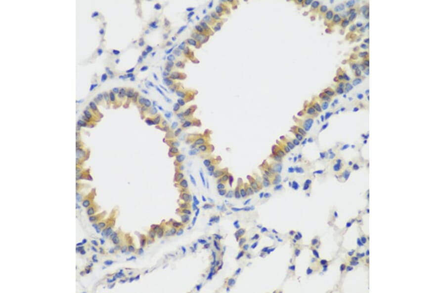 Immunohistochemistry - Anti-VEGF Receptor 3 Antibody (A11851) - Antibodies.com