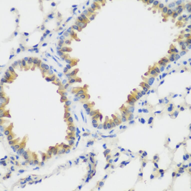 Immunohistochemistry - Anti-VEGF Receptor 3 Antibody (A11851) - Antibodies.com