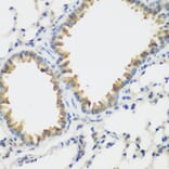 Immunohistochemistry - Anti-VEGF Receptor 3 Antibody (A11851) - Antibodies.com