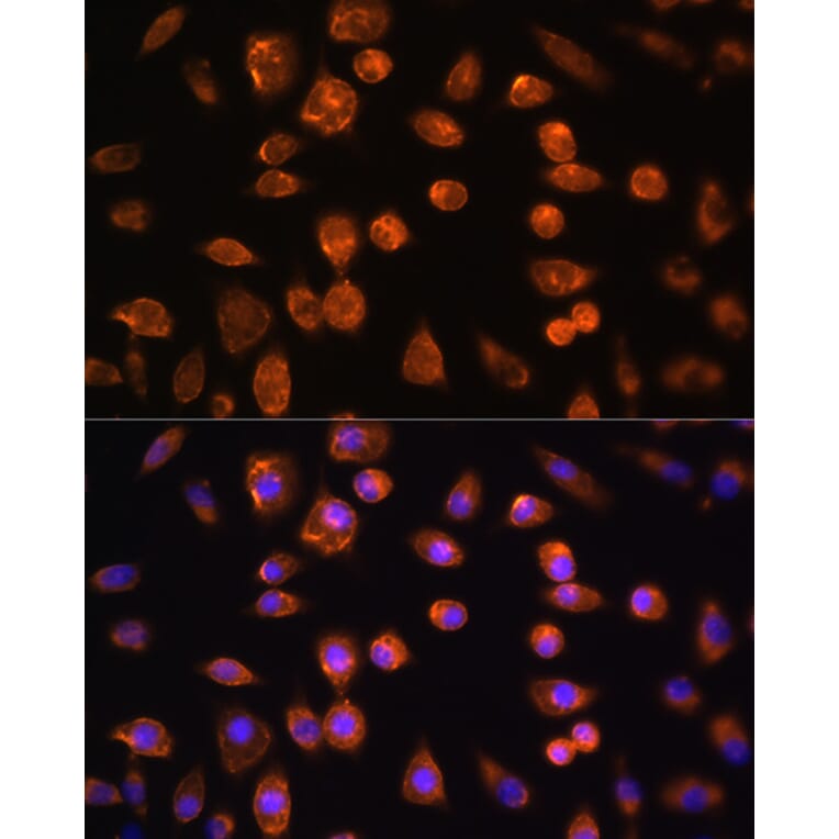 Immunofluorescence - Anti-VEGF Receptor 3 Antibody (A11851) - Antibodies.com