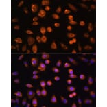 Immunofluorescence - Anti-VEGF Receptor 3 Antibody (A11851) - Antibodies.com