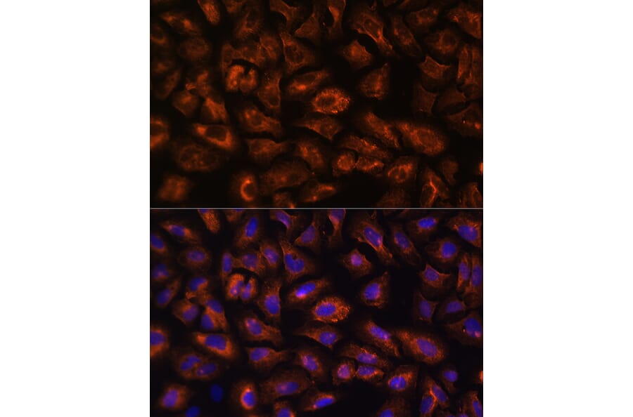 Immunofluorescence - Anti-VEGF Receptor 3 Antibody (A11851) - Antibodies.com