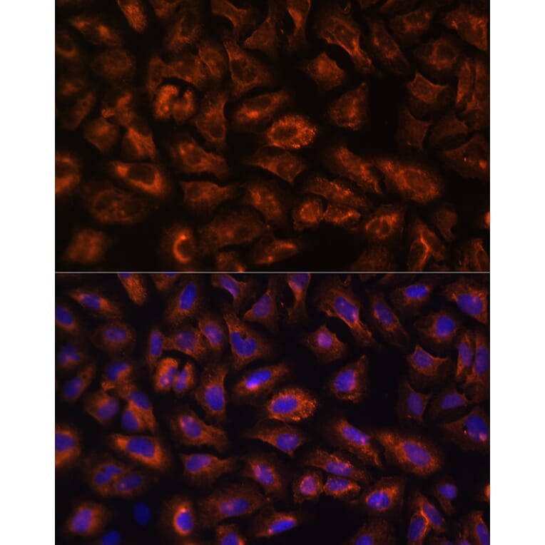 Immunofluorescence - Anti-VEGF Receptor 3 Antibody (A11851) - Antibodies.com