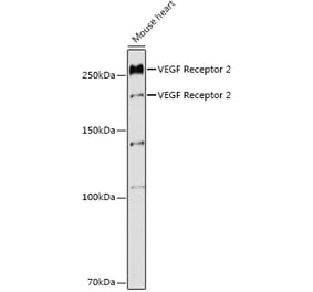 Western Blot - Anti-VEGF Receptor 2 Antibody (A11853) - Antibodies.com