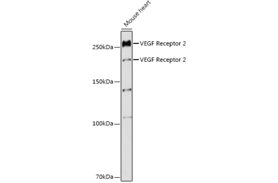 Western Blot - Anti-VEGF Receptor 2 Antibody (A11853) - Antibodies.com