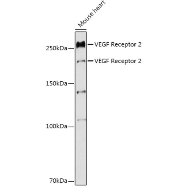Western Blot - Anti-VEGF Receptor 2 Antibody (A11853) - Antibodies.com