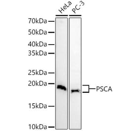 Western Blot - Anti-PSCA Antibody (A11854) - Antibodies.com