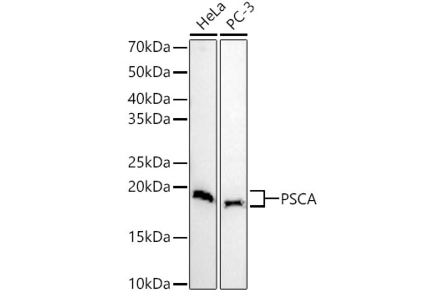 Western Blot - Anti-PSCA Antibody (A11854) - Antibodies.com