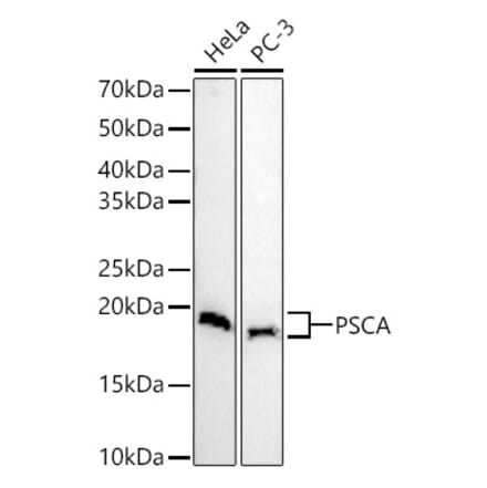 Western Blot - Anti-PSCA Antibody (A11854) - Antibodies.com