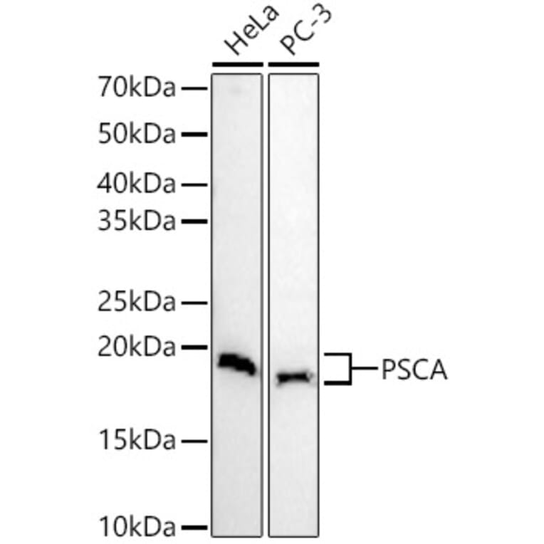 Western Blot - Anti-PSCA Antibody (A11854) - Antibodies.com