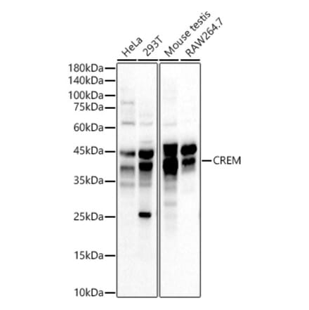 Western Blot - Anti-ICER Antibody (A11855) - Antibodies.com
