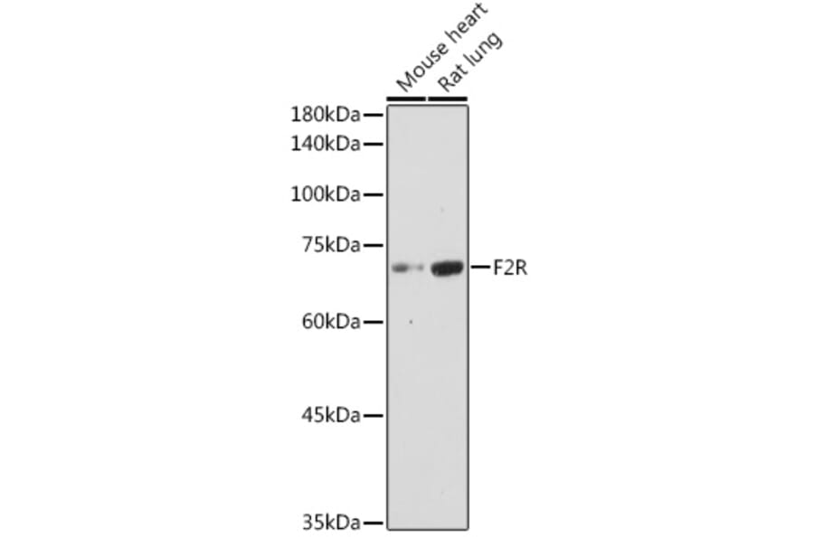 Western Blot - Anti-PAR1/Thrombin Receptor Antibody (A11856) - Antibodies.com