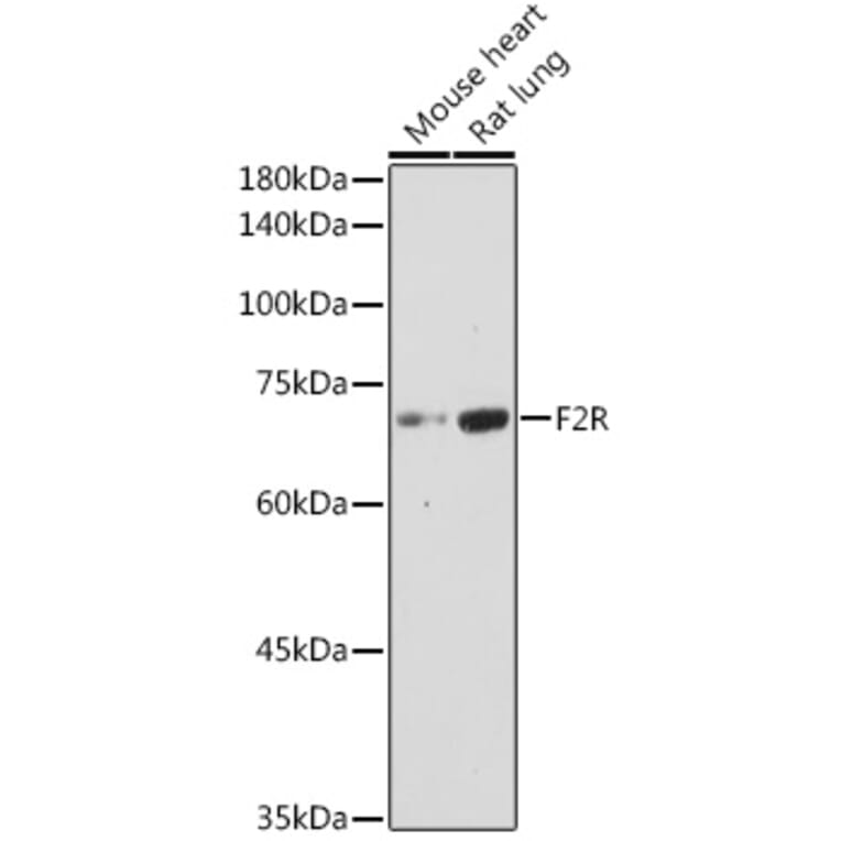 Western Blot - Anti-PAR1/Thrombin Receptor Antibody (A11856) - Antibodies.com