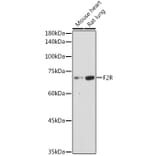 Western Blot - Anti-PAR1/Thrombin Receptor Antibody (A11856) - Antibodies.com