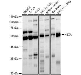 Western Blot - Anti-HEXA Antibody (A11857) - Antibodies.com