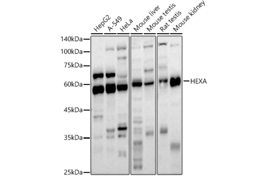 Western Blot - Anti-HEXA Antibody (A11857) - Antibodies.com