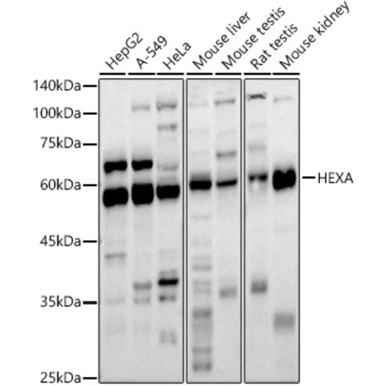 Western Blot - Anti-HEXA Antibody (A11857) - Antibodies.com