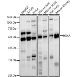 Western Blot - Anti-HEXA Antibody (A11857) - Antibodies.com