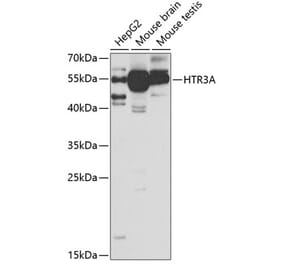 Western Blot - Anti-5HT3A Receptor Antibody (A11858) - Antibodies.com