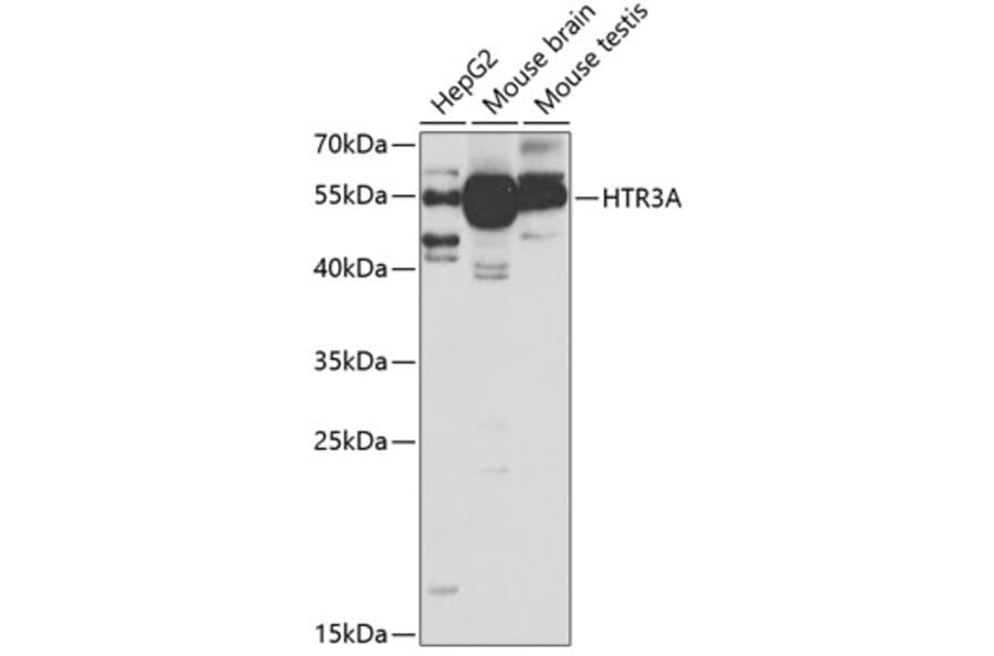 Western Blot - Anti-5HT3A Receptor Antibody (A11858) - Antibodies.com