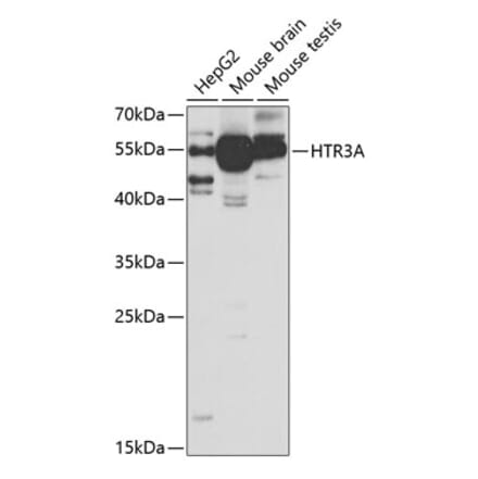 Western Blot - Anti-5HT3A Receptor Antibody (A11858) - Antibodies.com