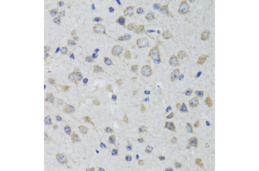 Immunohistochemistry - Anti-5HT3A Receptor Antibody (A11858) - Antibodies.com