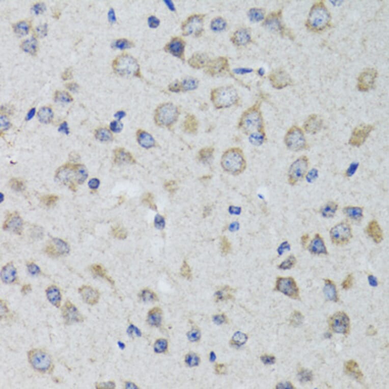 Immunohistochemistry - Anti-5HT3A Receptor Antibody (A11858) - Antibodies.com