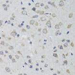 Immunohistochemistry - Anti-5HT3A Receptor Antibody (A11858) - Antibodies.com