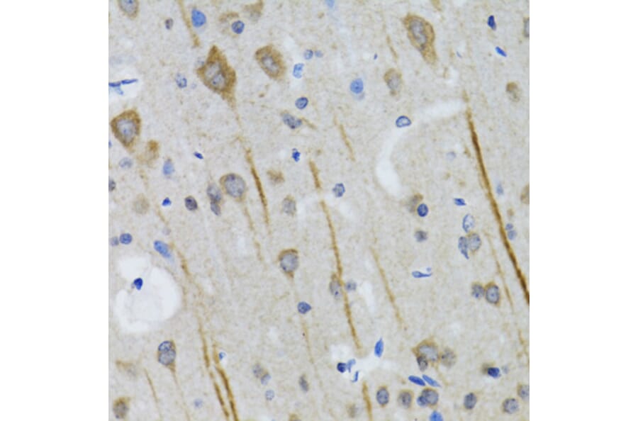 IHC - Anti-5HT3A Receptor Antibody (A11858)