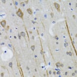 Immunohistochemistry - Anti-5HT3A Receptor Antibody (A11858) - Antibodies.com