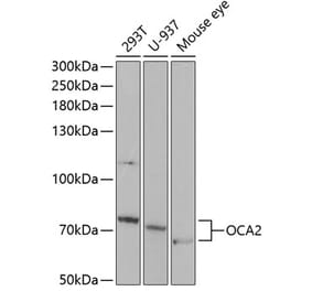 Western Blot - Anti-OCA2 Antibody (A11859) - Antibodies.com